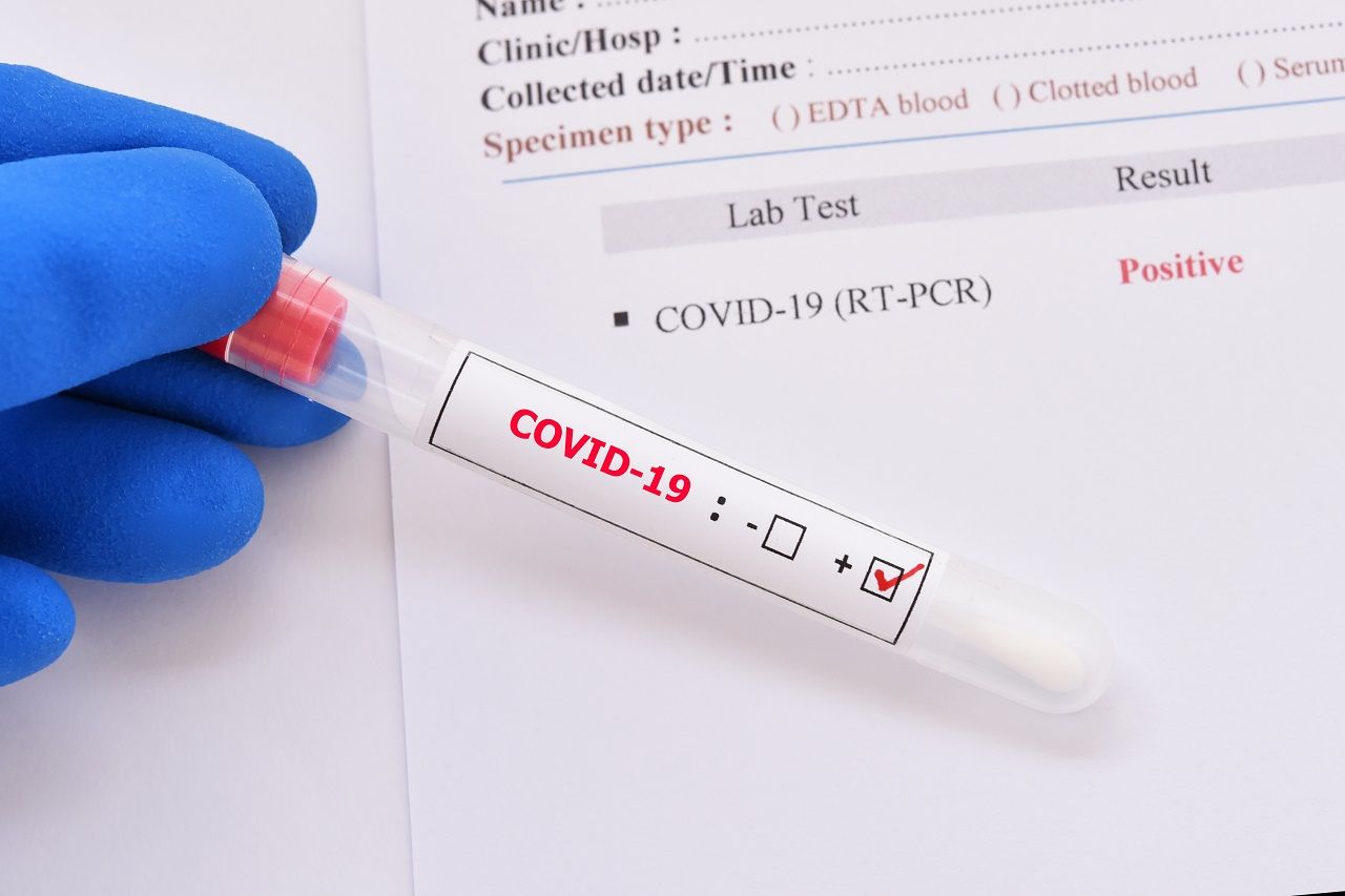 ตรวจโควิดแบบ RT-PCR จะได้ผลแม่นยำที่สุด