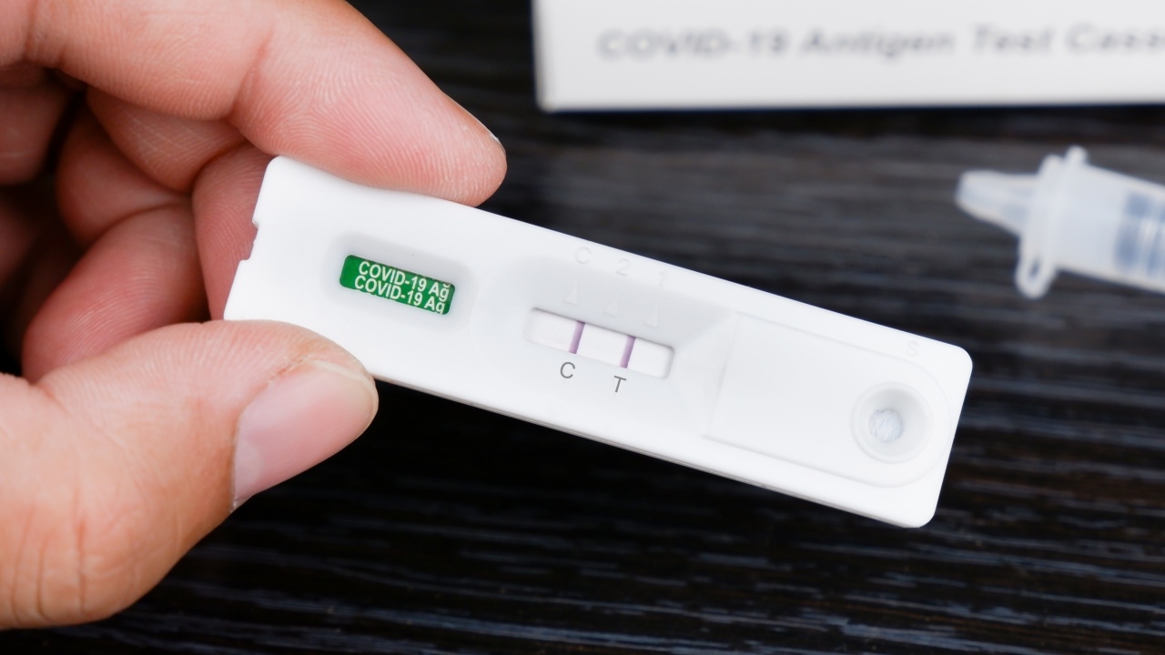 "หมอยง" เผย "โควิด-19" แม้จะระบาดอย่างมาก แต่ความรุนแรงของโรคลดลง